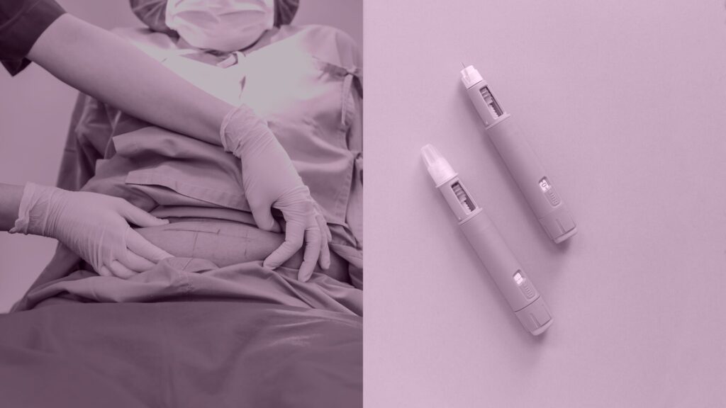 Cirurgia Bariátrica ou Caneta Emagrecedora para emagrecimento